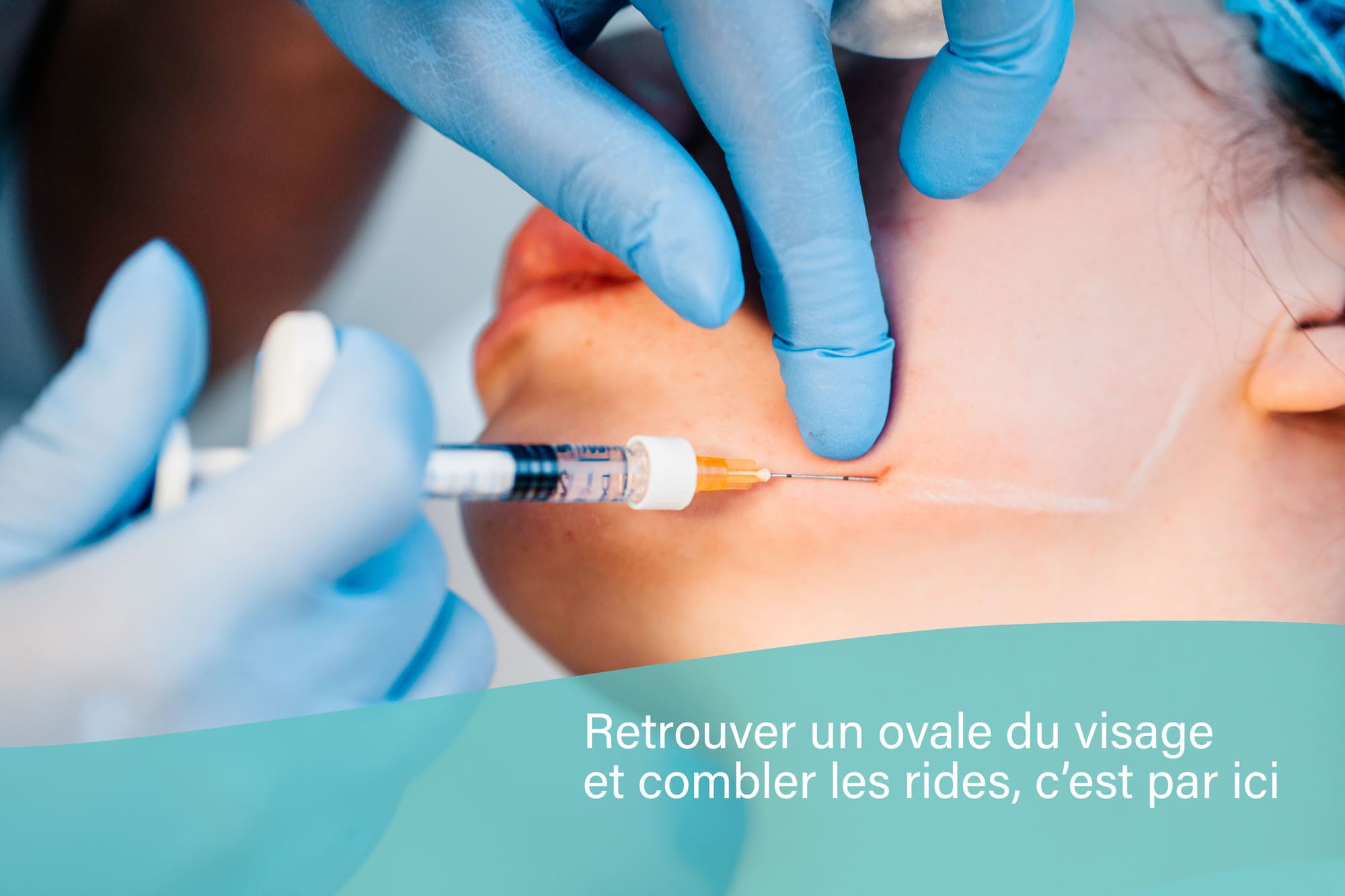 Lipofilling visage