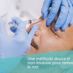 Rhinoplastie par acide hyaluronique