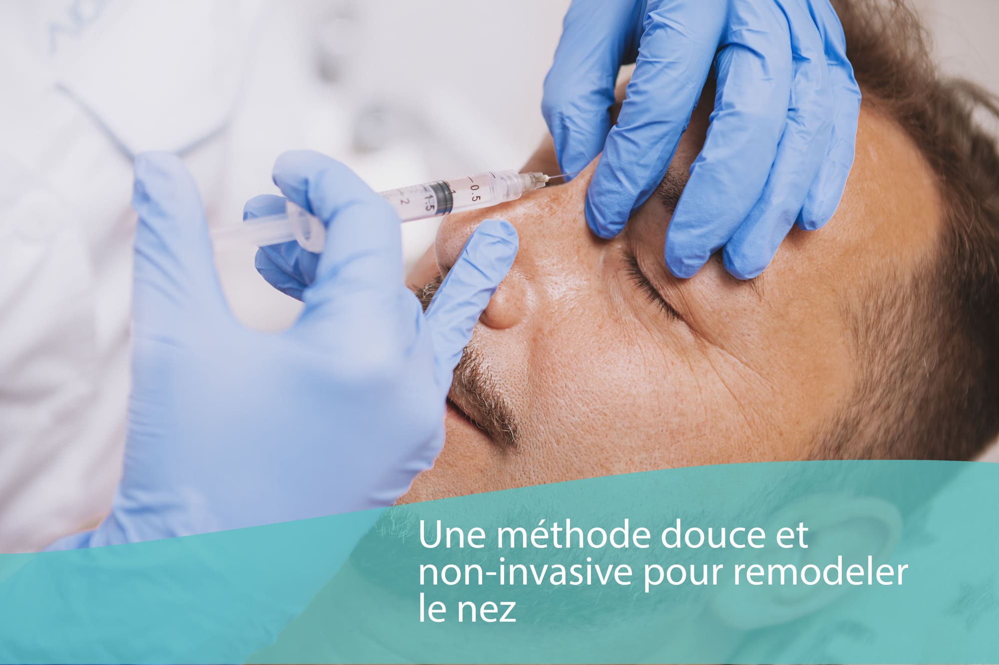 Rhinoplastie par acide hyaluronique
