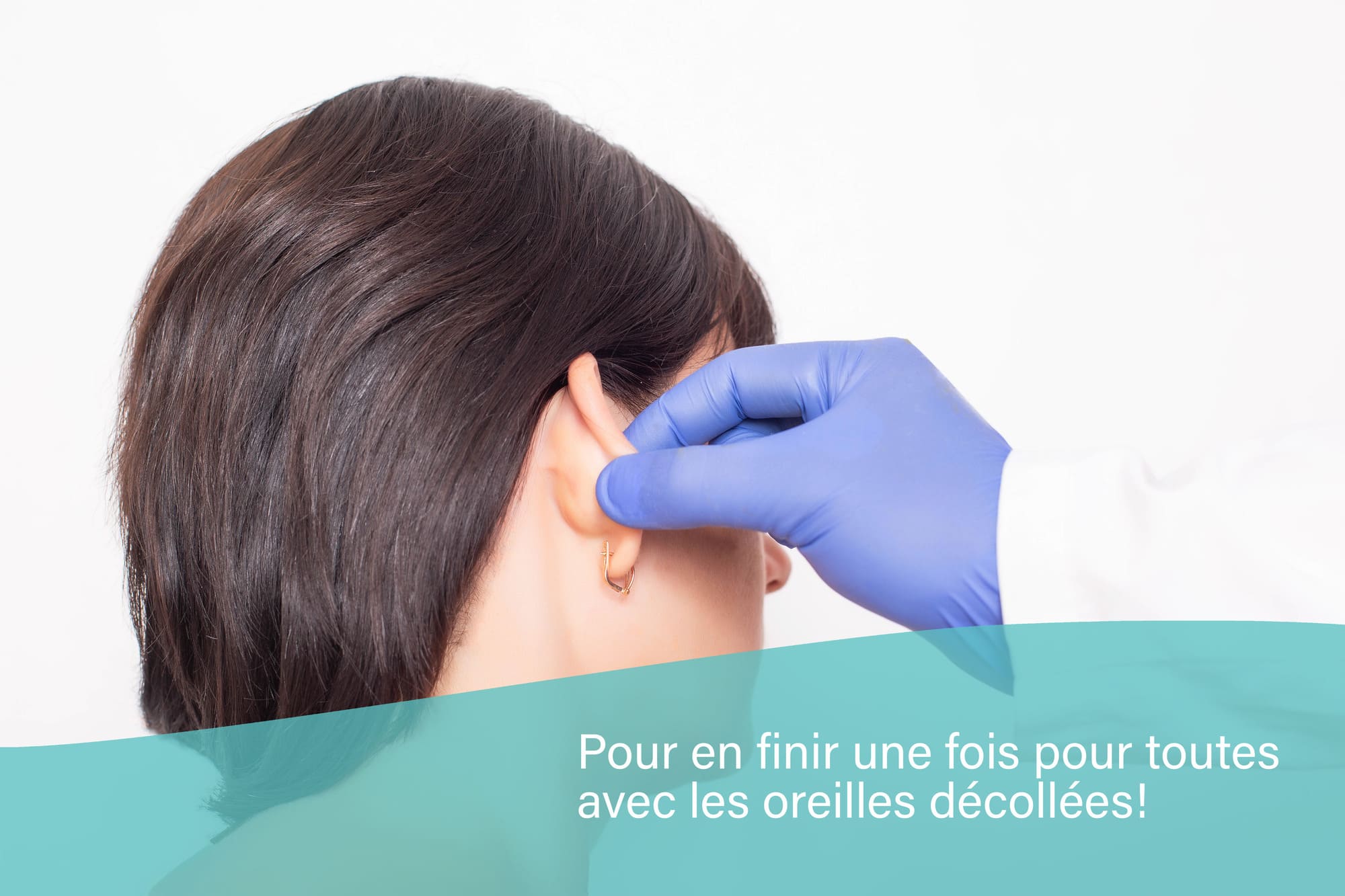 Otoplastie