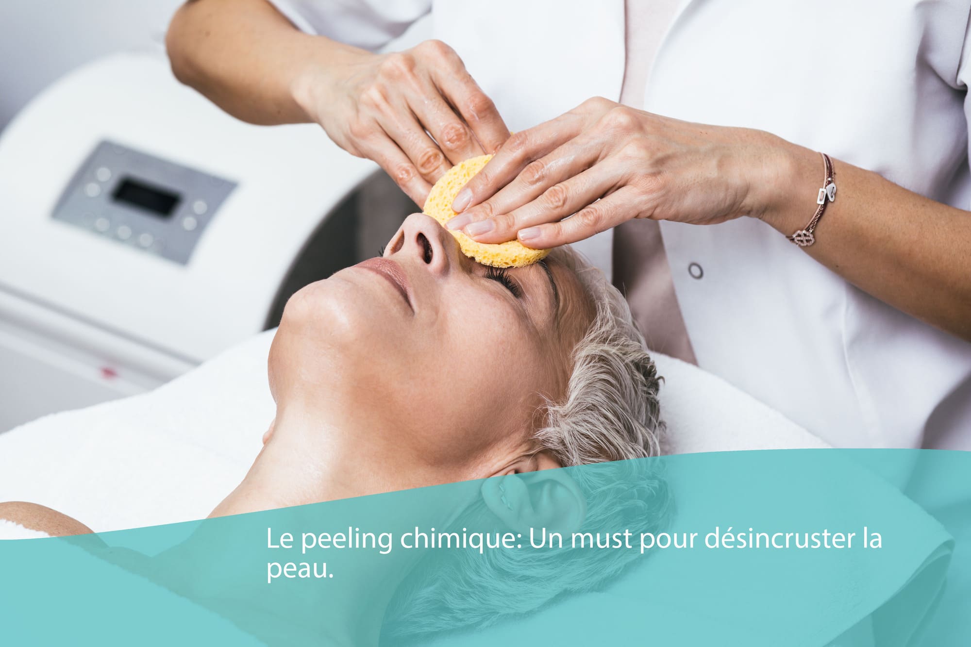 Peeling chimique