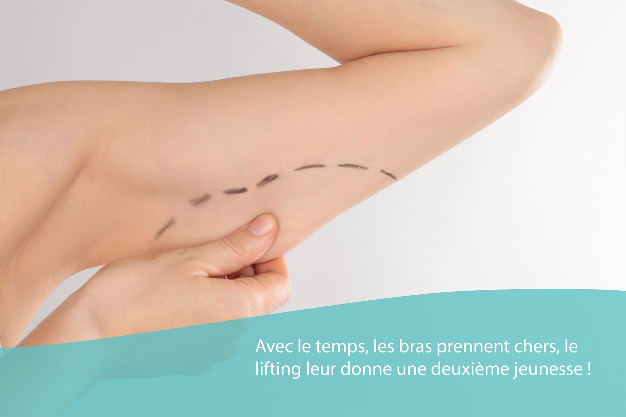Lifting des bras