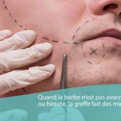 Barbe