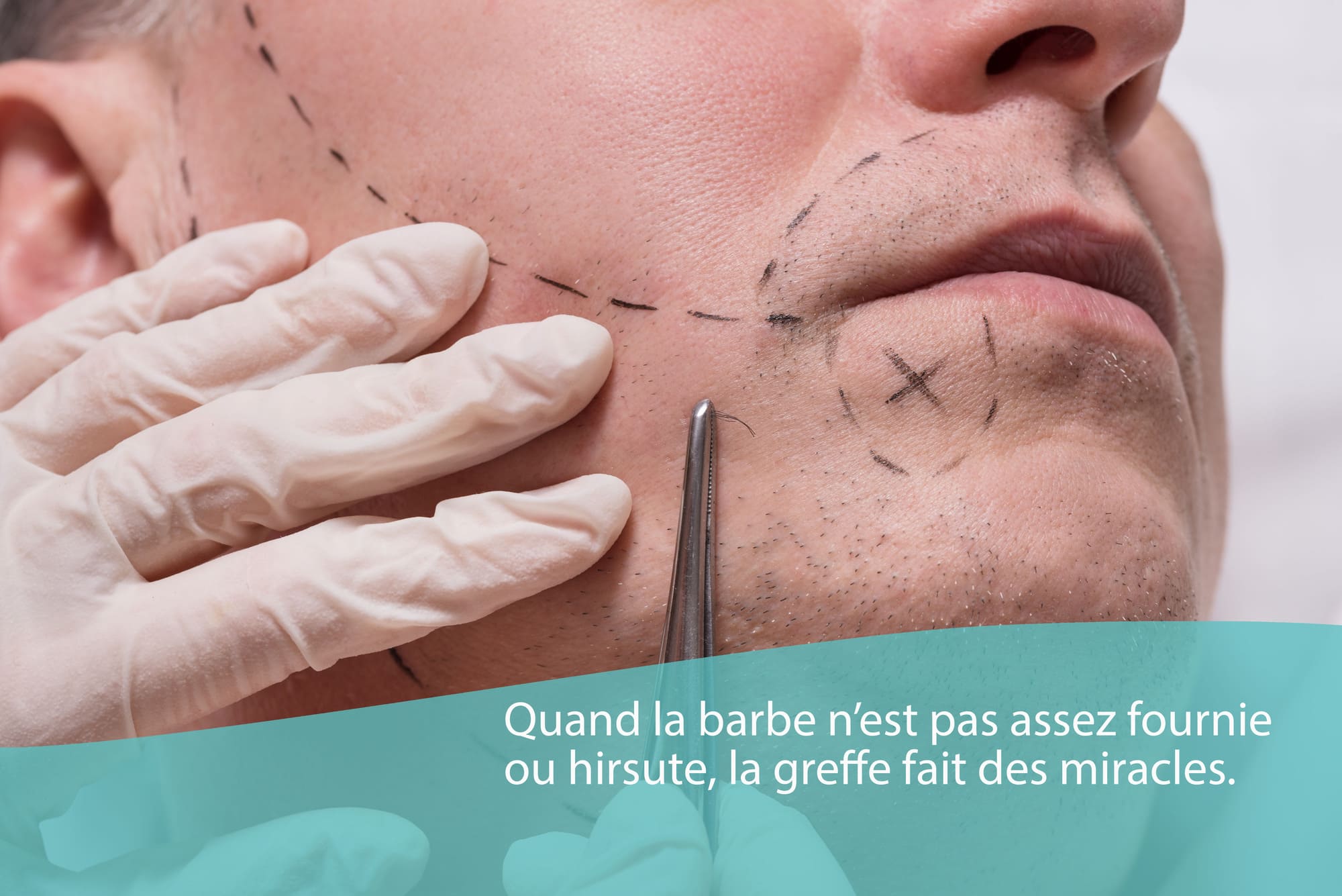Barbe
