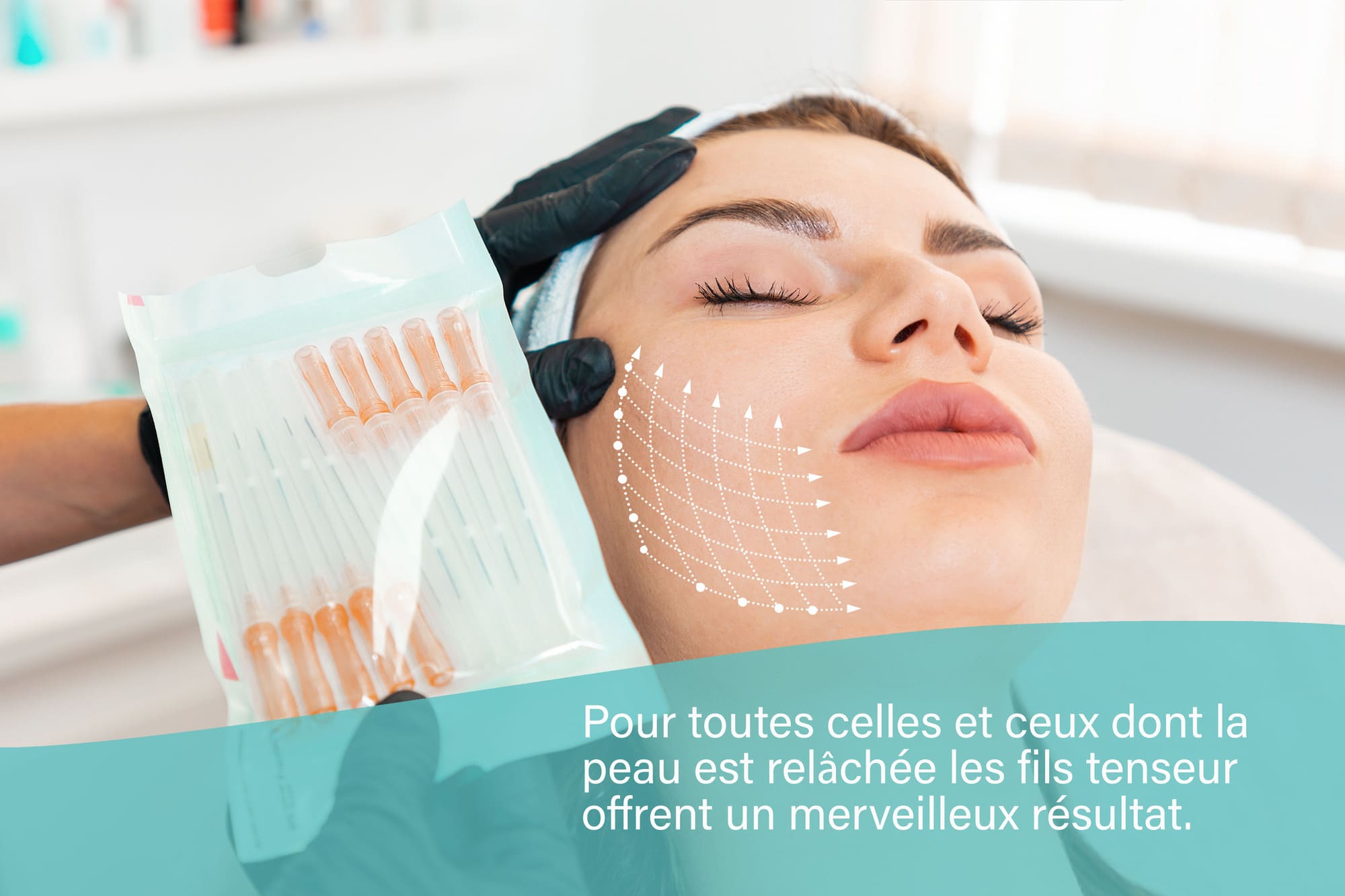 Fils tenseurs